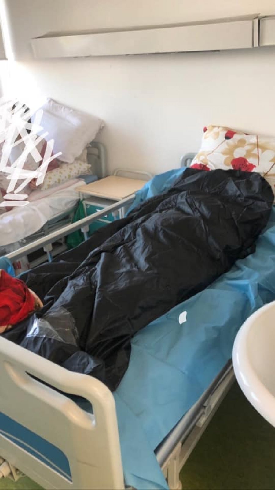 WP 31 - Skandal: E vdekura me COVID-19 u la me orë të tëra në dhomë me pacientë të tjerë