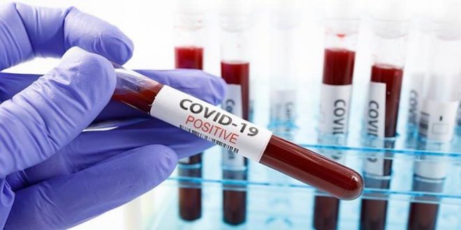 rsz junik 1 660x3301 1 - 18 raste të reja pozitive me COVID-19 në Ferizaj dhe 3 të shëruar