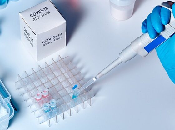 is 200316 coronavirus covid19 test 800x4501 560x416 - Lëshohen teste PCR të falsifikuara, arrestohet punëtori i poliklinikës në Ferizaj