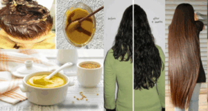 maske u 300x160 - Recetat Natyrale për Rritjen e Flokëve