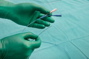 csm AdobeStock 553008846 5bb3eac428 1 300x200 - Koronarografia – Çfarë është dhe cilat janë efektet anësore?